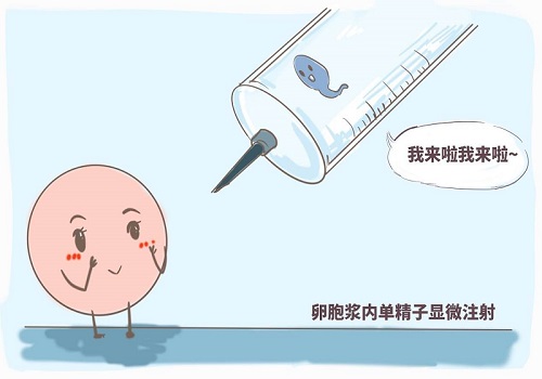 专家：美国试管婴儿对于异位妊娠的应对措施