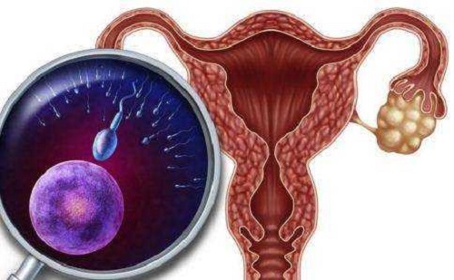 试管婴儿促排方案该怎么选？哪种方案最佳？