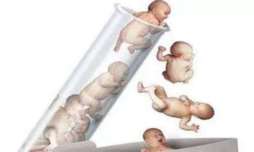 俄罗斯试管婴儿可以去选吗