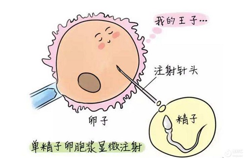 做输卵管造影后，多久可以去美国做试管婴儿？