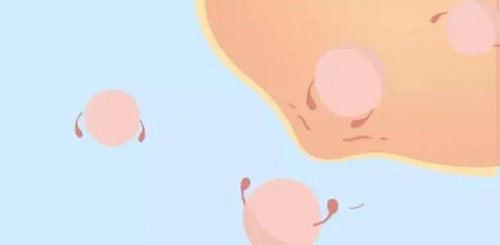 针对卵巢功能差的情况，做美国试管婴儿前如何调养一下？