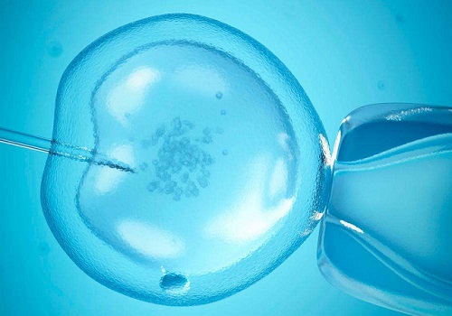 FSH高，美国试管婴儿专家如何科学促排？